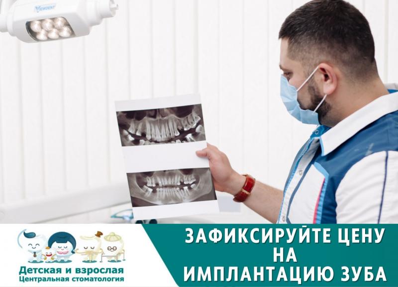 СТОП ЦЕНА - ИМПЛАНТАЦИЯ ЗУБА системой OSSTEM 24100₽
