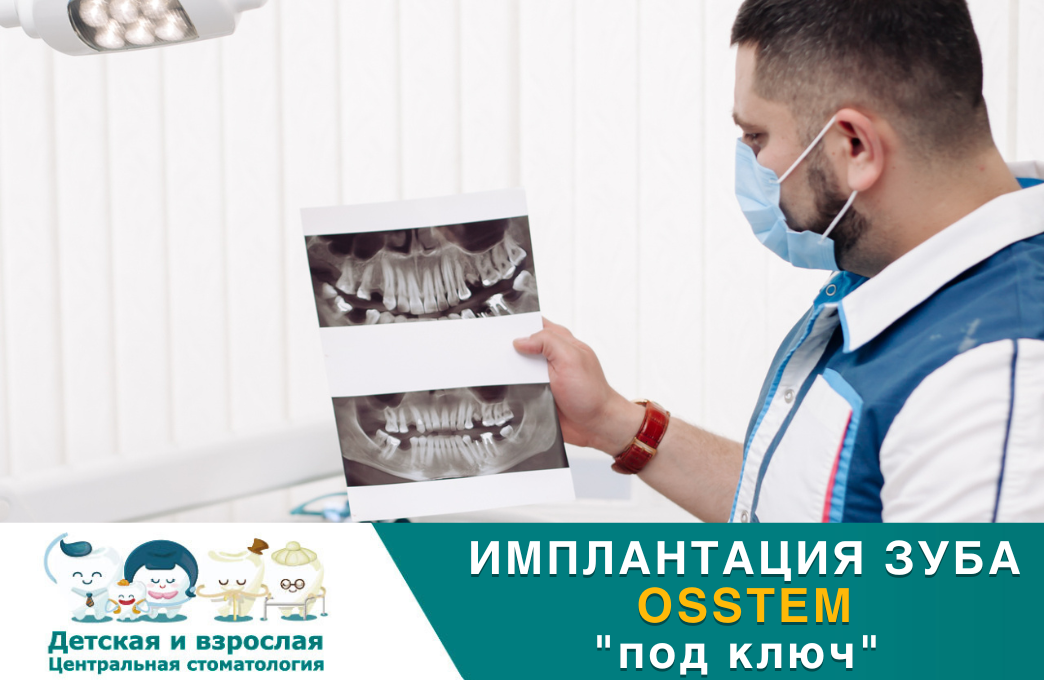 Имплантация зуба OSSTEM (Корея) "под ключ" 50 400руб.