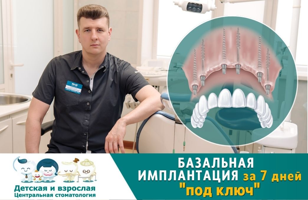 БАЗАЛЬНАЯ ИМПЛАНТАЦИЯ ЗУБОВ