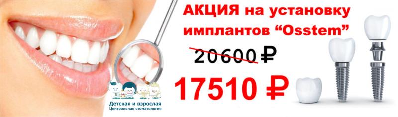 АКЦИЯ НА УСТАНОВКУ ИМПЛАНТОВ "OSSTEM"