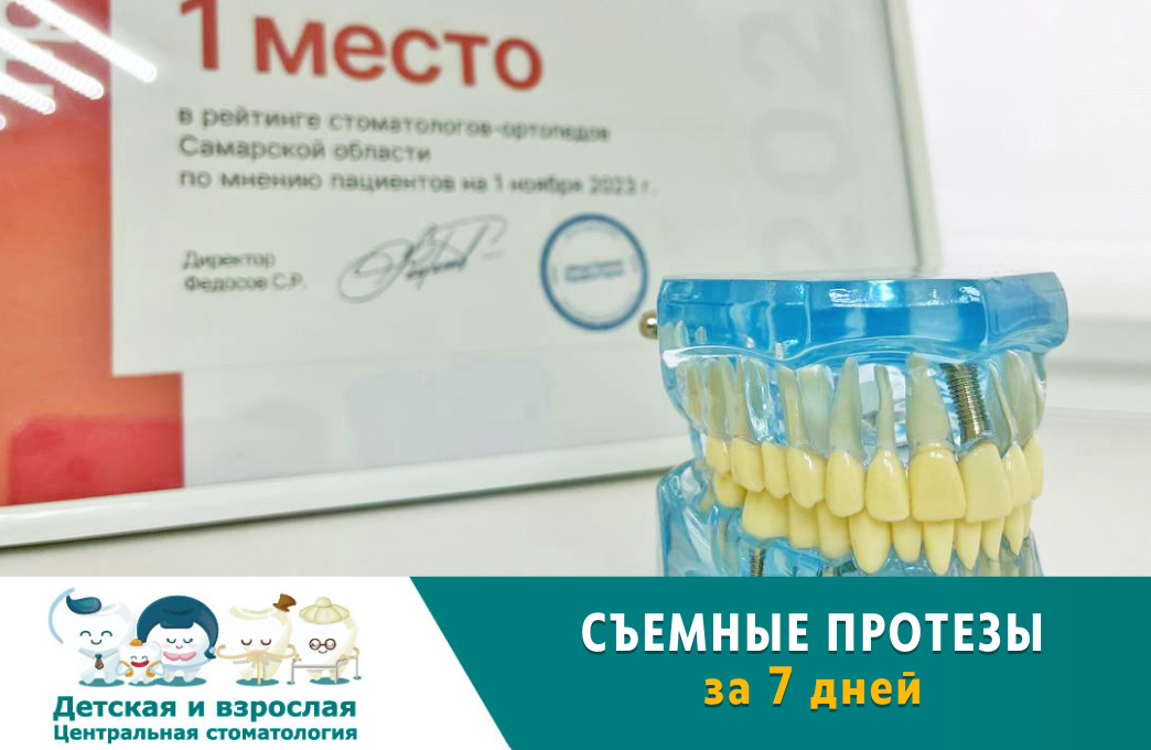 СЪЕМНЫЕ ПРОТЕЗЫ